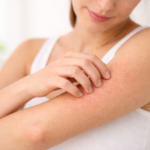 5 Reasons Why Your Skin is Itching